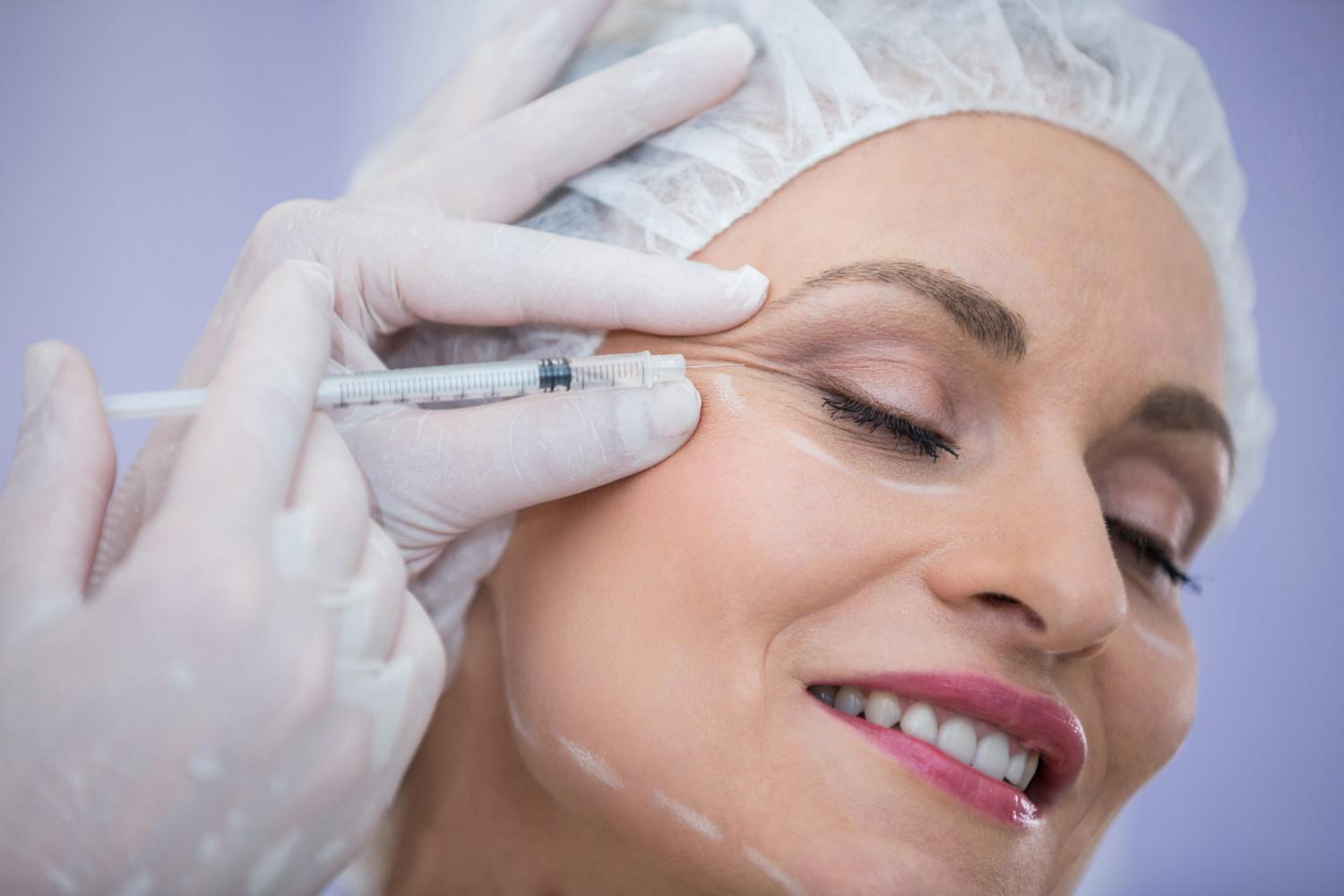 Mulher aplicando botox no rosto, simbolizando quanto tempo dura o botox
